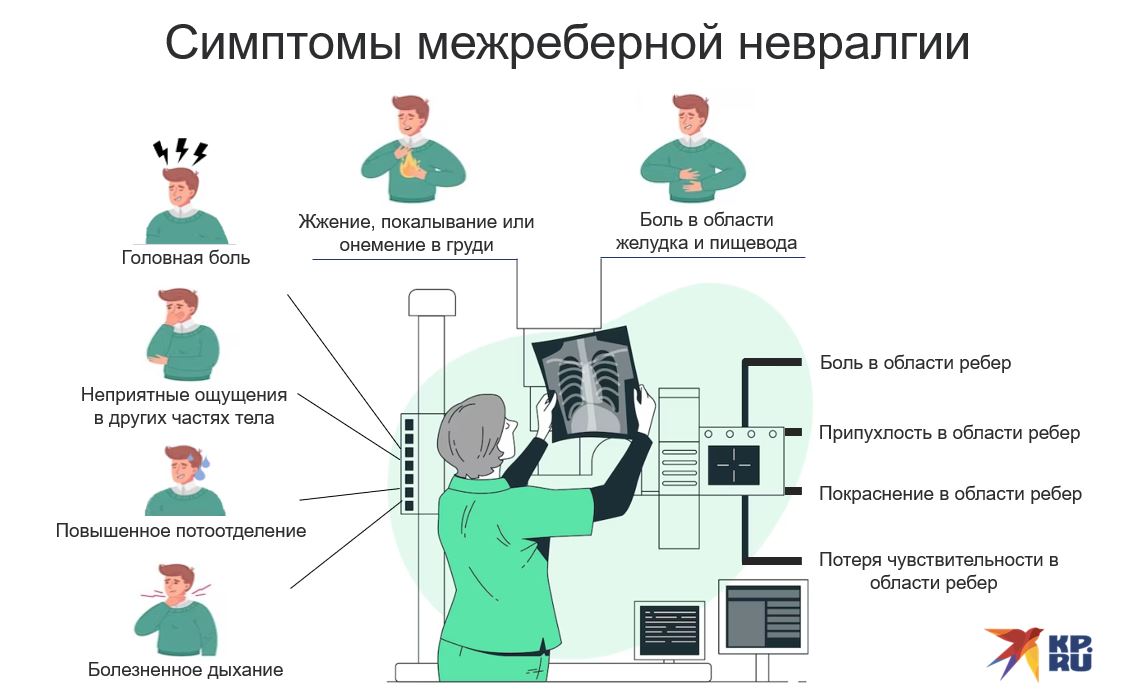 10 симптомов межреберной невралгии у взрослых: как проявляются симптомы межребер