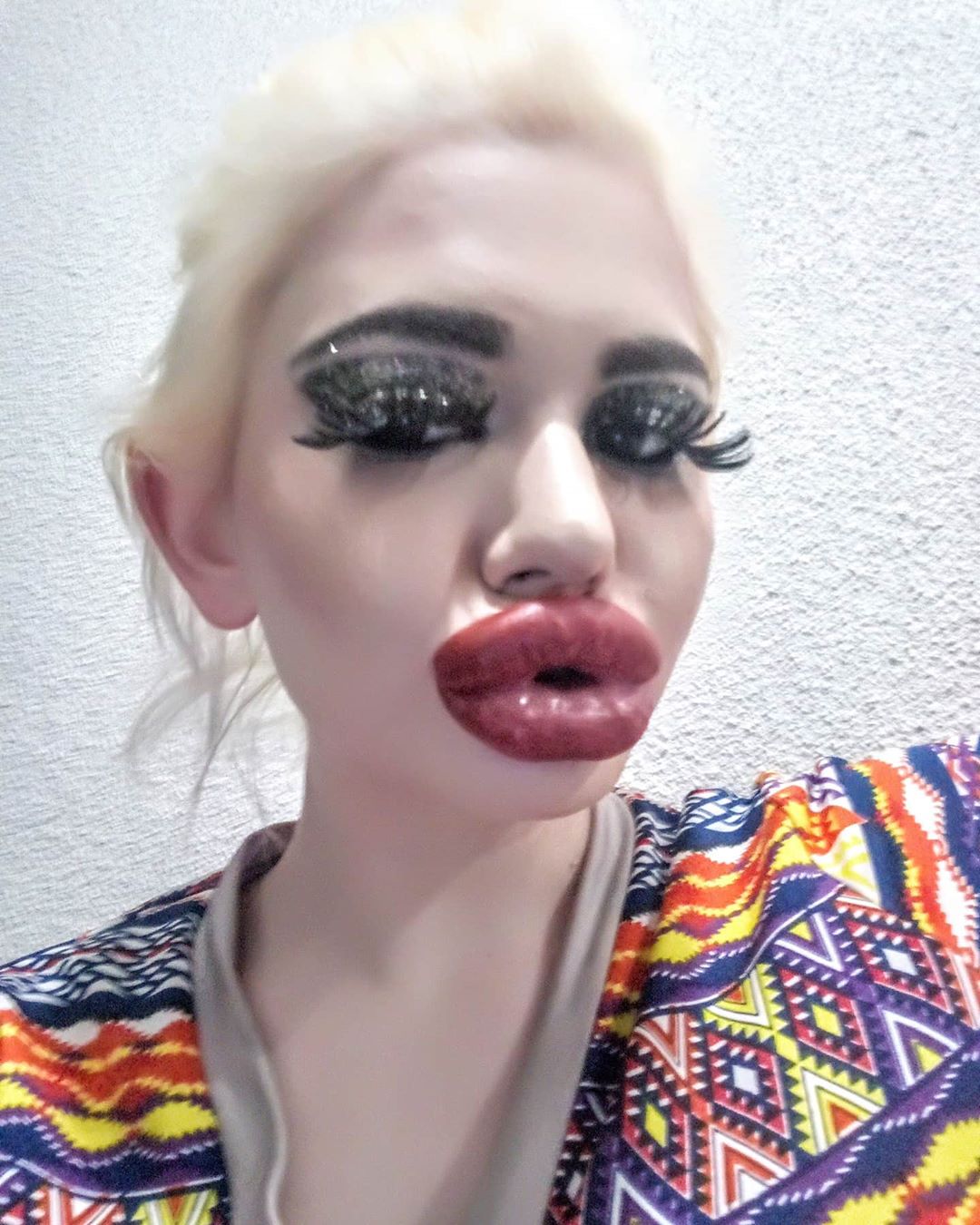 Большие губы